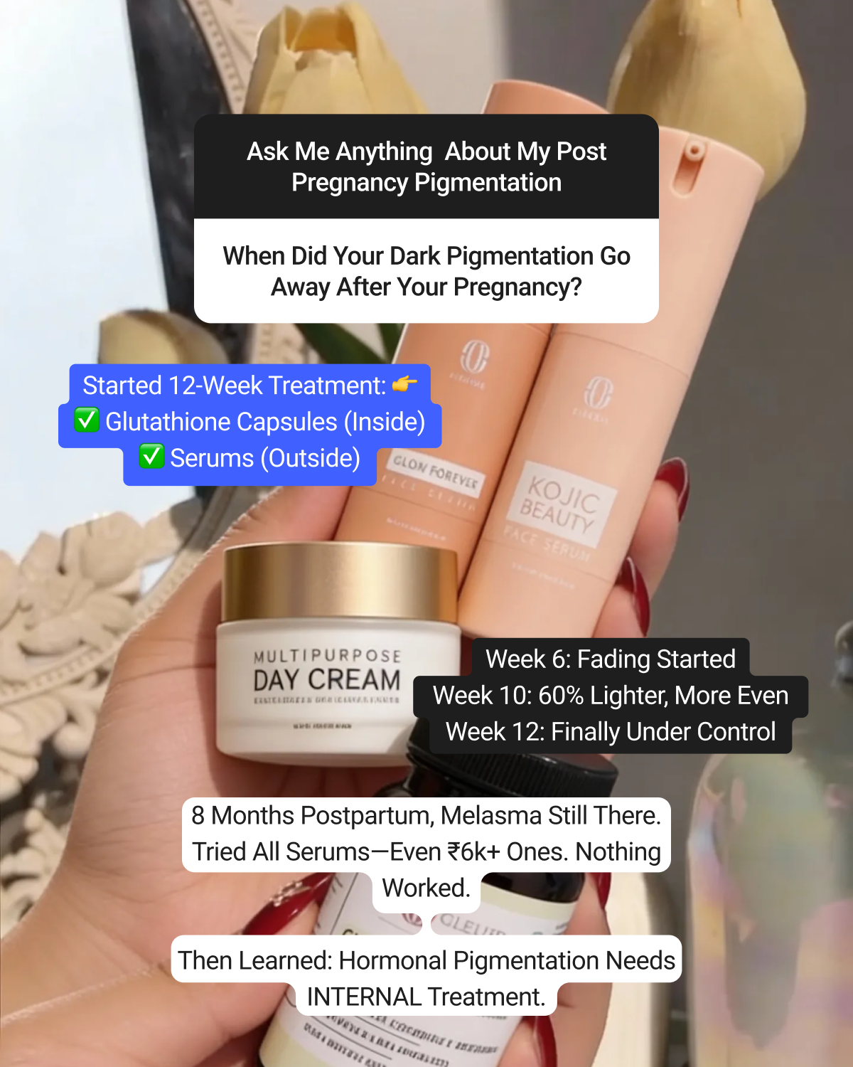 12-Week Post-Pregnancy & Hormonal PigmentationTreatment