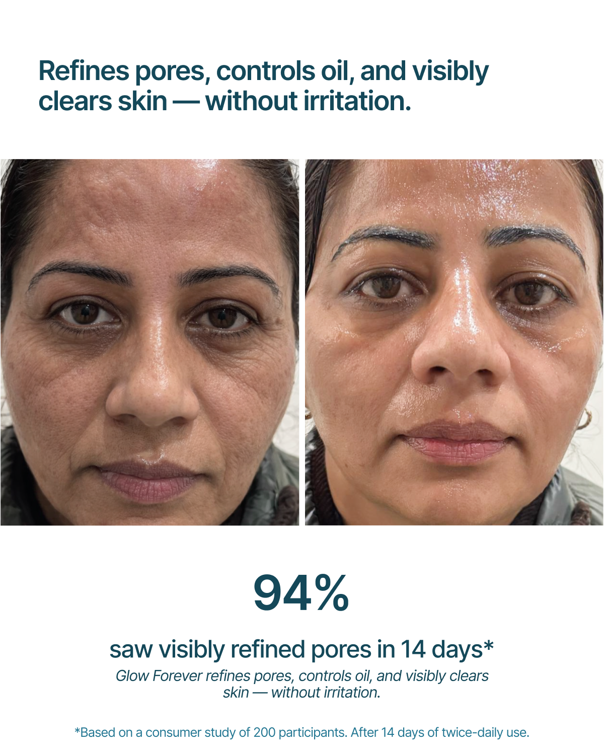 Glow Forever.. 14-Day Dark Spot & Pore Refining Serum