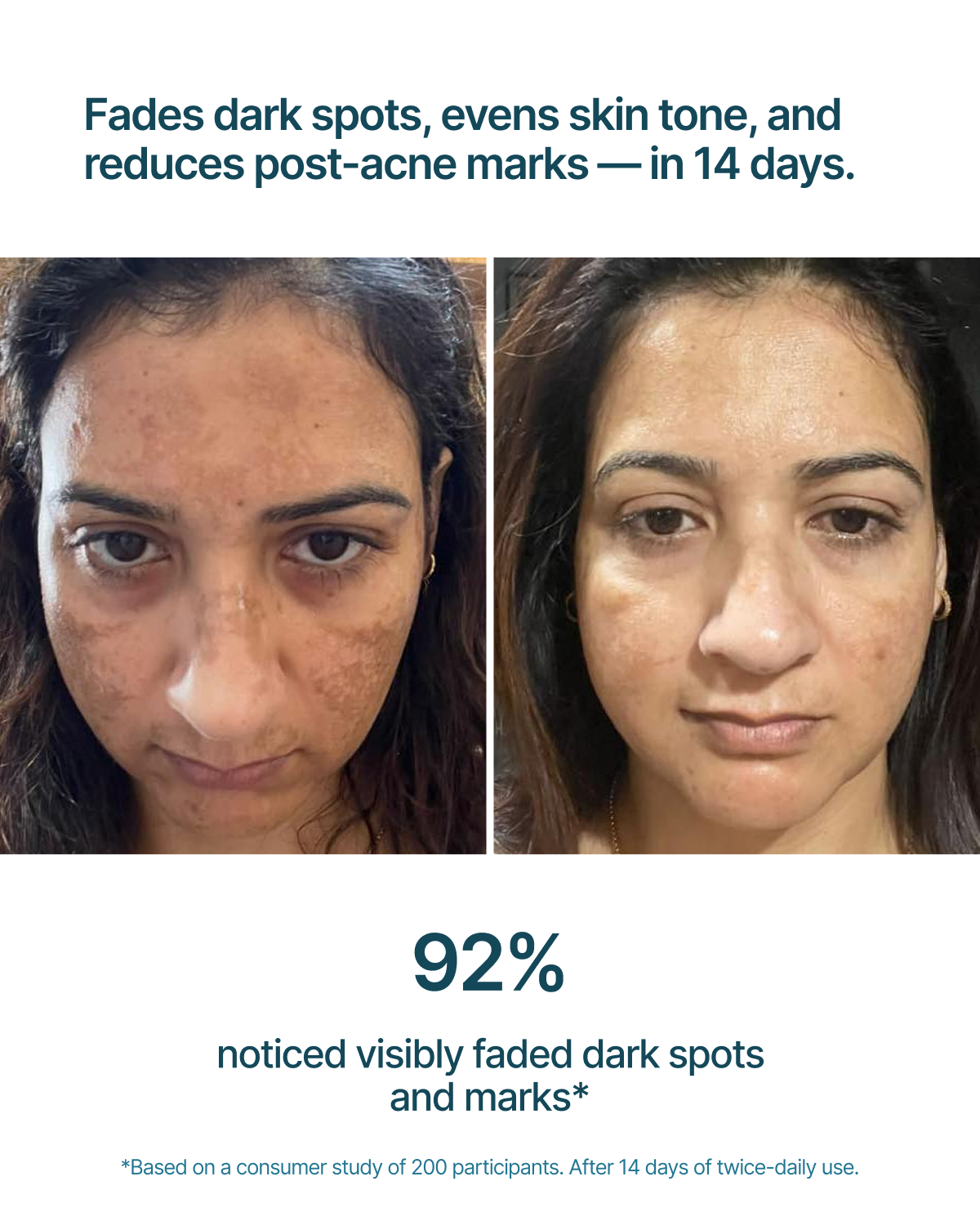 Glow Forever.. 14-Day Dark Spot & Pore Refining Serum