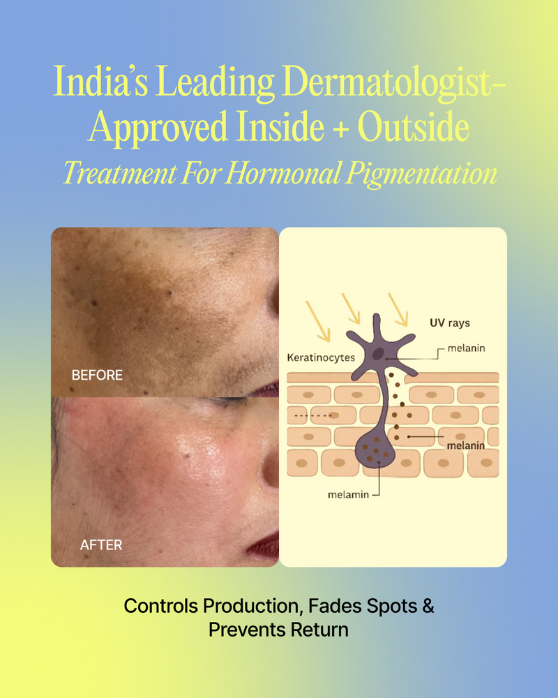 12-Week Post-Pregnancy & Hormonal PigmentationTreatment - alt view