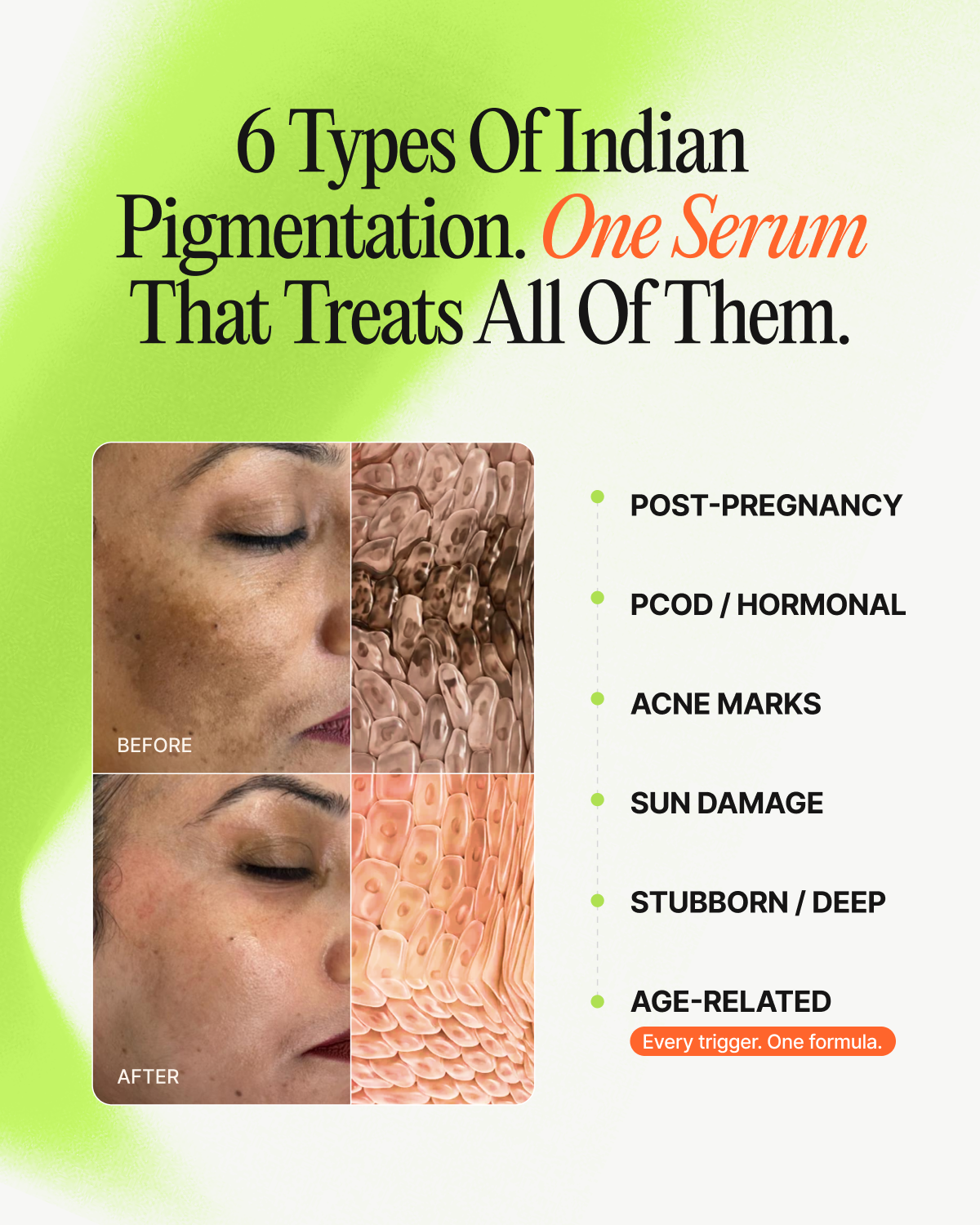 Gluta Beauty — India’s First 5-Pathway Pigmentation Serum