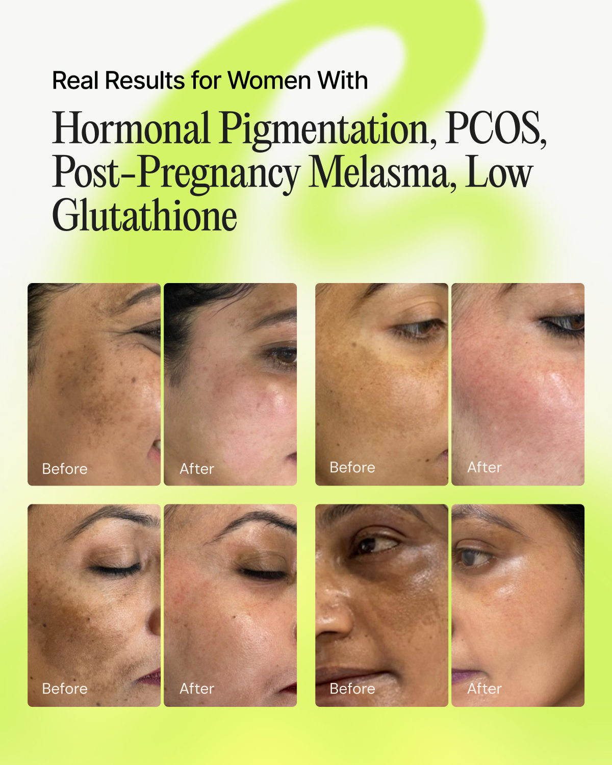 glutathione injections before and after Glutathione for Dogs | Liver Detox & Allergy Support main image 1