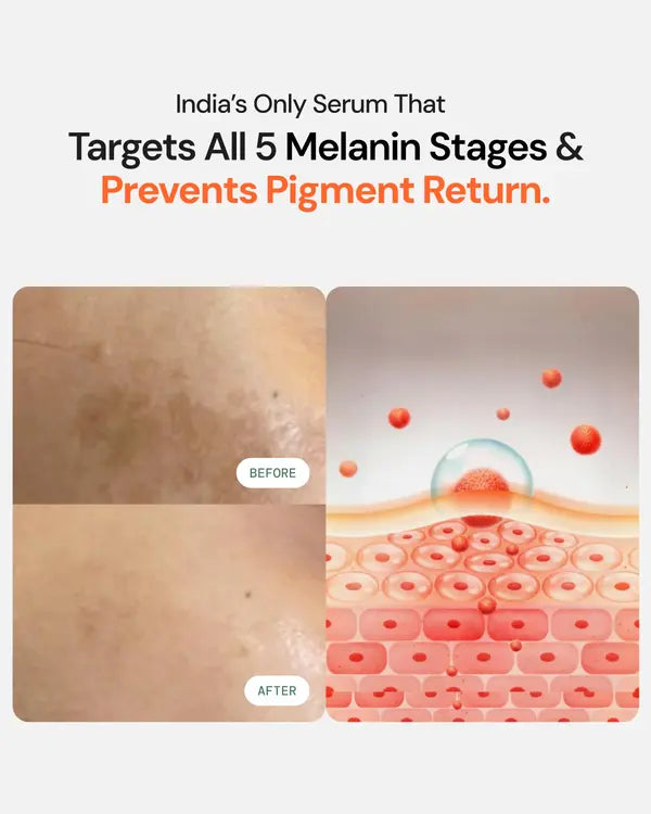 Glutathione 4 Week Advanced Brightening & Pigmentation Serum alt