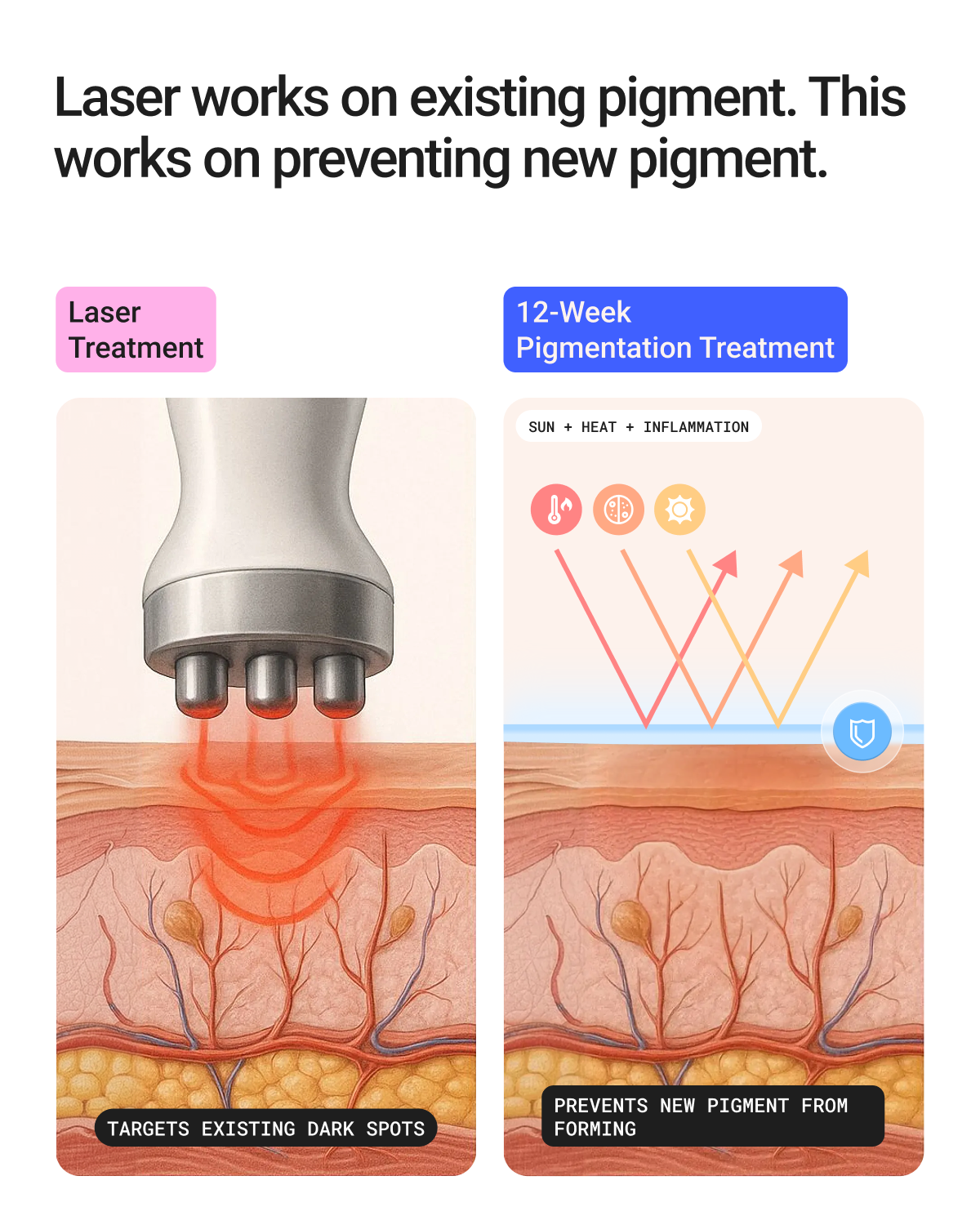 12-Week Pigmentation Treatment