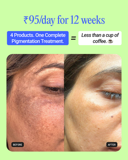 12-Week Pigmentation Treatment