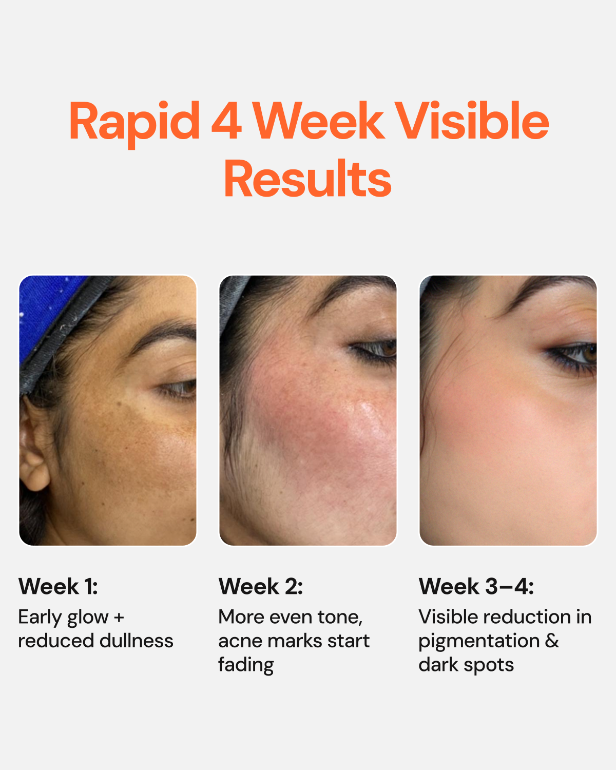 Glutathione 4 Week Advanced Brightening & Pigmentation Serum