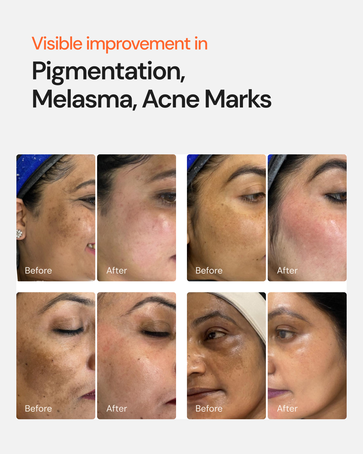 Glutathione 4 Week Advanced Brightening & Pigmentation Serum