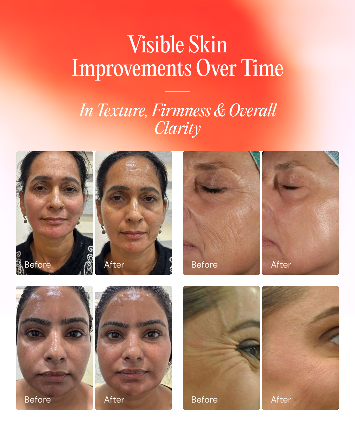 EGF 8-Week Advanced Anti-Aging Serum
