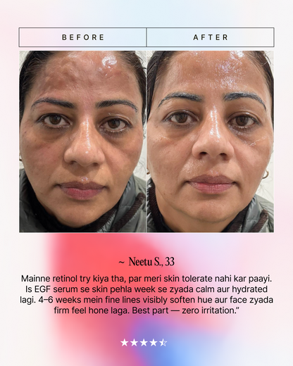 EGF 6-Week Advanced Anti-Aging Serum