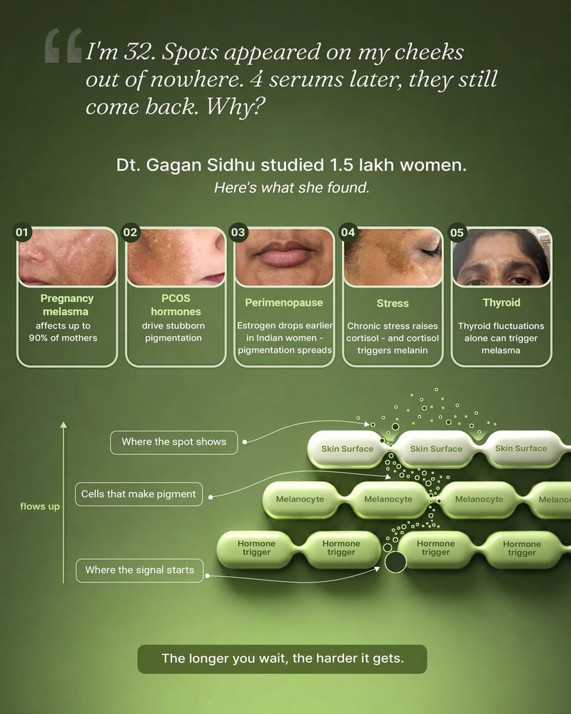 India's First Treatment For All 5 Hormonal Triggers Of Pigmentation. alt