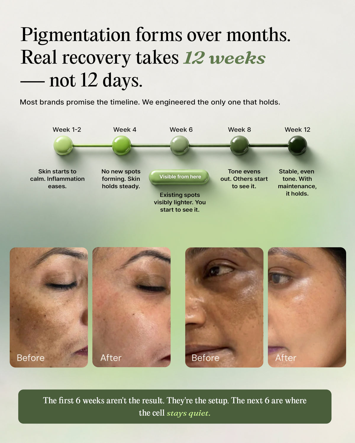 India's First Treatment For All 5 Hormonal Triggers Of Pigmentation.
