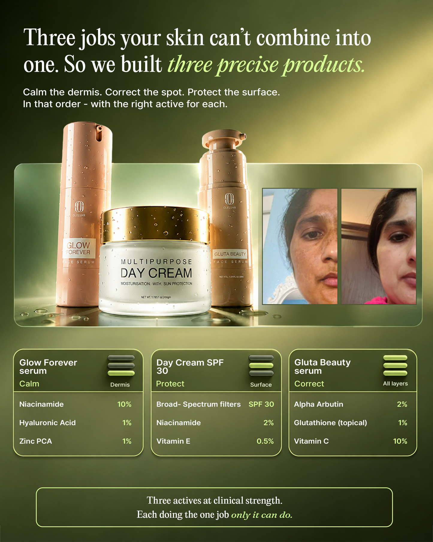 India's First Treatment For All 5 Hormonal Triggers Of Pigmentation.