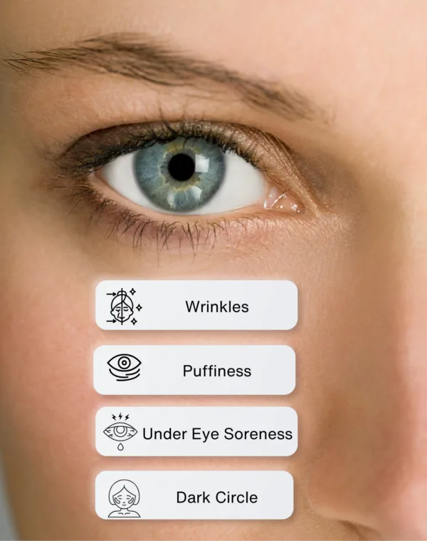 Eye Revive | Serum for Under Eye Puffiness , Dark Circles and Wrinkles | Hyaluronic Acid - Image 3