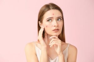 GLeuhr Advanced Anti-Acne Treatments