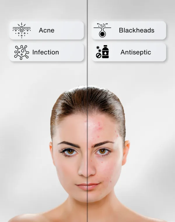 Tea Tree Face Wash, Cleanser for Oily, Acne Prone Skin | Women and Men - Image 3