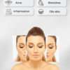 Purifying Serum | Serum for Acne, Blemishes and Pigmentation - Image 3