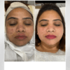 Purifying Serum | Serum for Acne, Blemishes and Pigmentation - Image 2