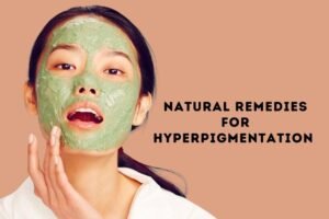 Natural Remedies for Hyperpigmentation