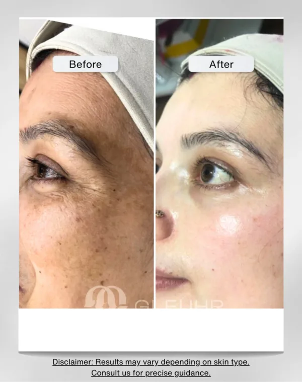 Gluta Beauty (Glutathione Face Serum for Skin, Whitening and Vitamin E) - Image 2