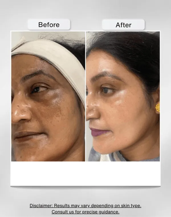 UV Armour Sunscreen (SPF 50) | Sunscreen for Sun Protection, Light, Normal to Dry Skin - Image 2